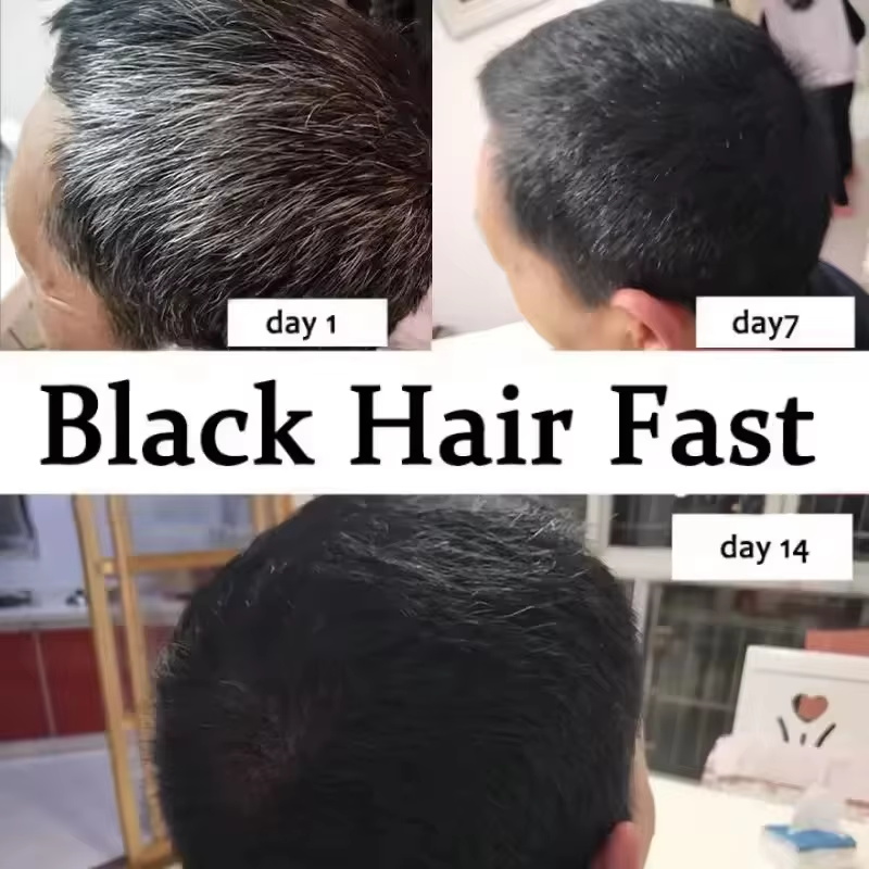 Haarserum voor grijs haar, dek - Hair Care Ginseng recensie en prijs