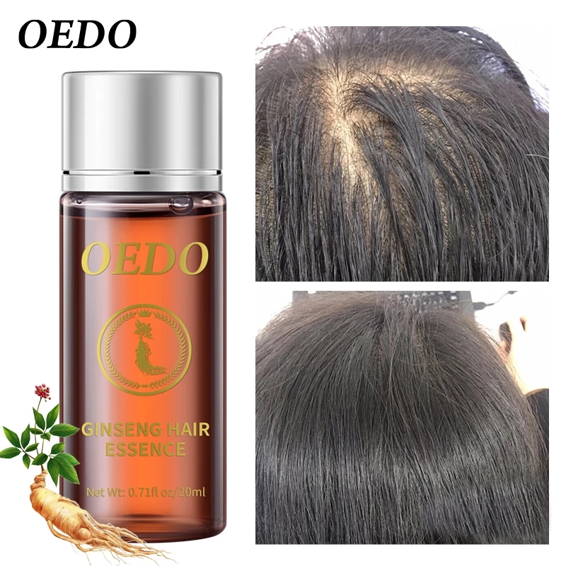 20ML Ginseng Haargroei Essenti - Hair Care Ginseng recensie en prijs