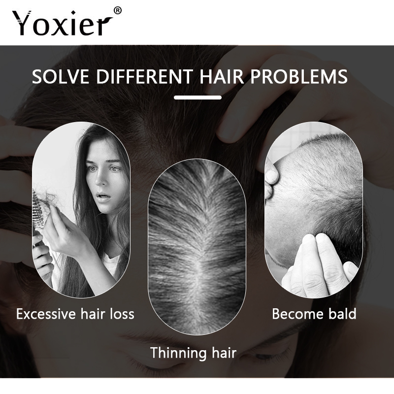 Intensieve Groei Serum Voorkom - Hair Care Serum recensie en prijs