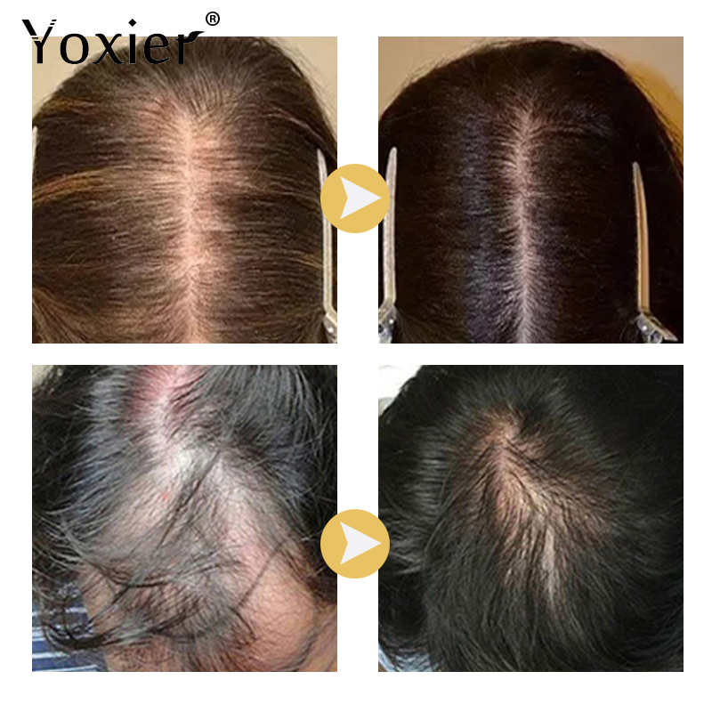 Intensieve Groei Serum Voorkom - Hair Care Serum recensie en prijs