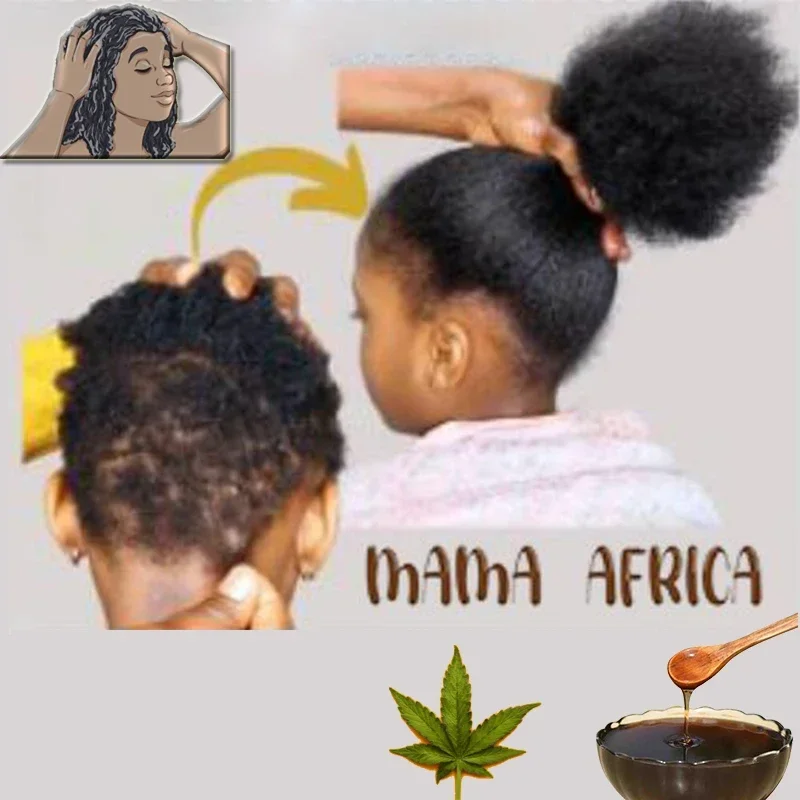 Afrika Vrouwen Tractie Alopeci - Hair Care Ginseng recensie en prijs