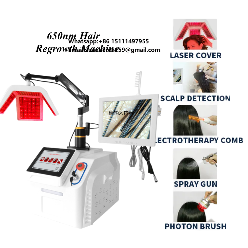 T 5-in-1 650nm Scalpverzorging - Hair Care For Hair Loss recensie en prijs