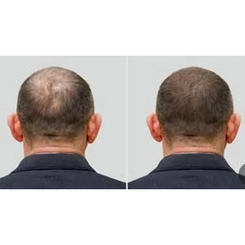 Goede Seal Ozone Cap Ozonmuts  - Hair Care Good Hair recensie en prijs