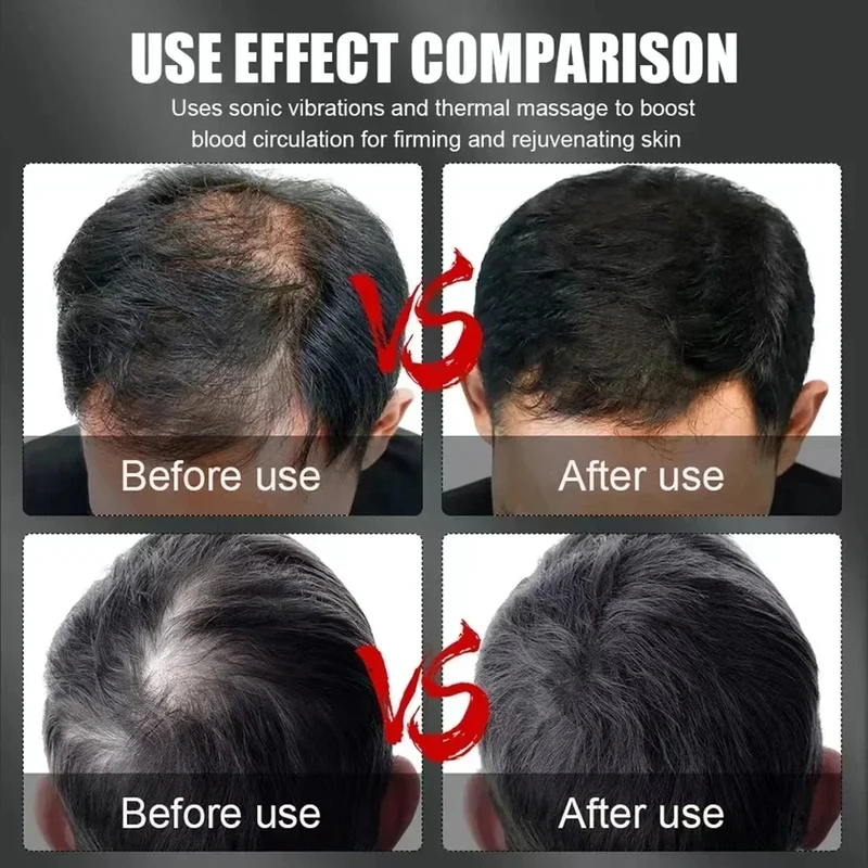 660nm 850nm Rood Licht Infraro - Hair Care For Hair Loss recensie en prijs